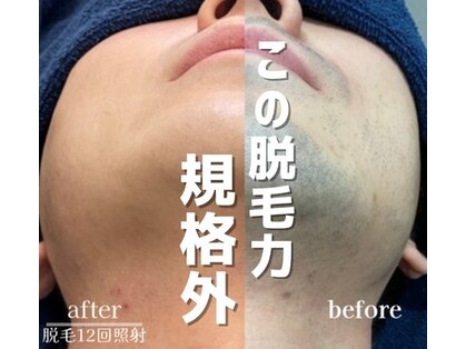 エピジェンスの写真