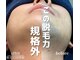 エピジェンスの写真