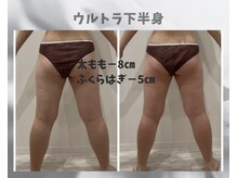 フルーア(FULUA)/ウルトランスフォーマー下半身