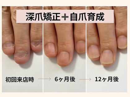 ネイルズシアムの写真