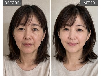 アプロ(Aphro)/鏡が楽しくなる顔