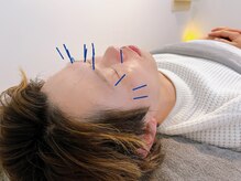 つむぎ鍼灸整骨院/眼精疲労