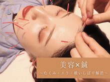 いいとこ鍼灸院