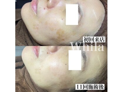 ホワラ 福岡博多店(Whila)の写真