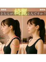 美座ノ女 梅田 淀屋橋本店&nbsp;施術前後 （横側）