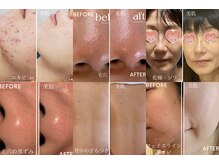 クリスタの雰囲気（サロンケア×スキンケアで自分史上最高の韓国美肌へ。）