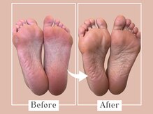 ベベ(Bebe)/40代女性/ガサガサ・タコお悩み