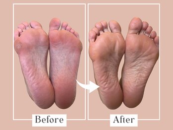 ベベ(Bebe)/40代女性/ガサガサ・タコお悩み