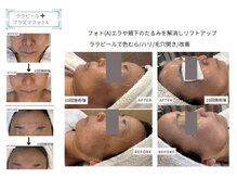 ベルスタイル(Bell style)/当店のお客様症例(美肌ケア)