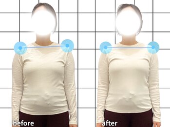 アクティブフィジオ 武蔵小杉(Active Physio)