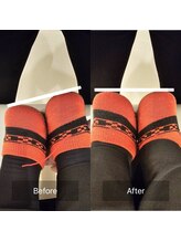 寿 千葉院(KOTOBUKI)/足がパンパンに張る方