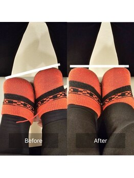 寿 千葉院(KOTOBUKI)/足がパンパンに張る方