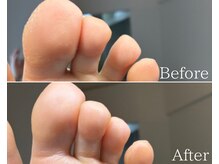 カシェット 広島店(Cachette)/40代女性☆足裏角質ケア90分