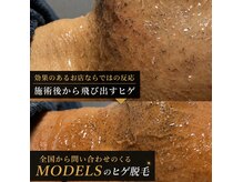 モデルズ(MODELS)の雰囲気（【ヒゲ脱毛】元祖飛び出すヒゲの発祥#メンズ脱毛松山）