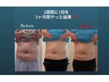 スタートフィットネス プラス エステ/ビフォーアフター