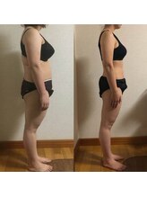 エアレ(eare)/全身痩身