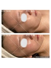 アユスリム(AYU SLIM)/一回でも変化できるの充実美顔