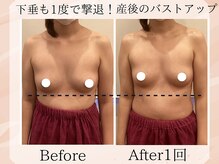 プレジィール/バストアップ/バストケア/下垂
