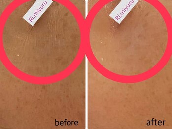 リミュール(Ri.miyuru)/シワ・トーンアップも