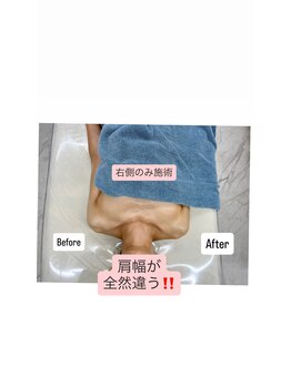 チュラ 大宮店(Chura)/華奢な肩幅も作れちゃいます♪