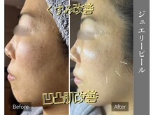 グロウ(glow.)/乾燥、毛穴、肌荒れ全てに