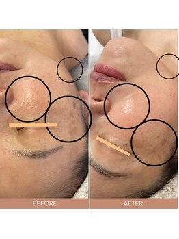 ルルーディア(LOULOUDIA)/大人女子必見!エイジングケア◎