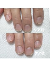 アメジスト(Amethyst)/自爪育成ケア！見た目印象アップ