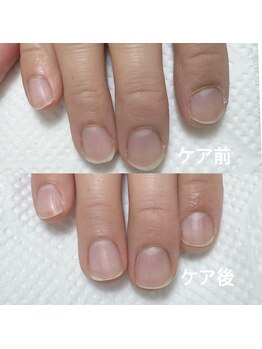 自爪育成ケア！見た目印象アップ