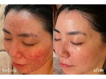 サロンムーン 赤坂(salon moon)の雰囲気(《ニキビ悩みに結果》艶美肌を目指すお客様から選ばれ続ける)