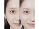 トゥルヌソル(tournesol)の写真/≪新！HBL導入≫眉毛のコンプレックスを改善！ハリウッドブロウリフトで「ふさっと憧れナチュラル眉」へ☆
