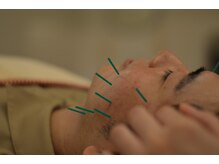 リボディ美容鍼灸院(Re±body美容鍼灸院)/メンズも歓迎
