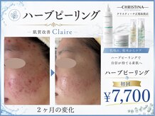 クレア(Claire)