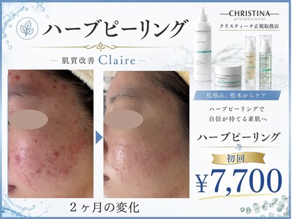 クレア(Claire)の写真