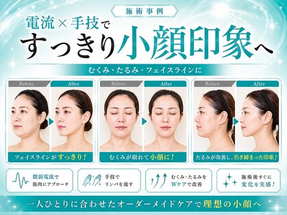 エテの写真