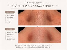 クラルテアンドコー(Salon Clarte&Co.)の雰囲気（2種類の美容液で毛穴詰まりを浮き出し、優しく毛穴をお掃除♪）