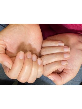 爪の悩みを解消できる（ケア含む）