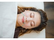 デルタエヌピー63+(δnp63+)/お客様施術例【小顔/薬院/福岡】