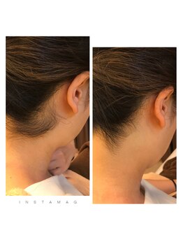 シェービングアンドエステ ブランピュア(Blanc pur)/襟足シェービング 2,530円