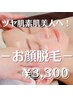 【顔脱毛】お顔丸ごとスピード脱毛！艶肌ノーファンデ素肌に！1回40分￥3300