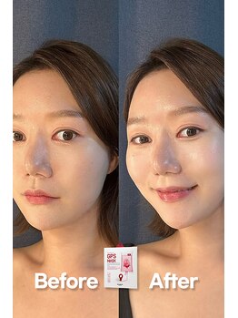 セレニテ(Serenite)/