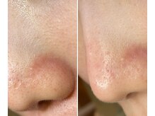 サイ(Sai)/before⇒after