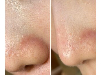 サイ(Sai)/before⇒after