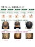 【専門店提携】【ヘアーロス】定期来店不要。まずはカウンセリングをどうぞ
