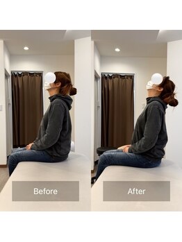 寿 千葉院(KOTOBUKI)/首の動きが悪いと感じる方