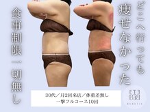 ベベティー(BEBETIE)/一撃フルで劇的大幅サイズダウン