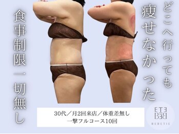 ベベティー(BEBETIE)/一撃フルで劇的大幅サイズダウン
