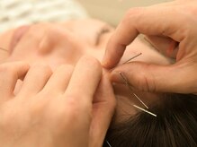 かがしまはりきゅう接骨院 鍼灸整体