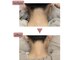 グロウ(Glowe)の写真