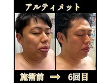 リリーローズ(LilyRose)の雰囲気（積み重ねで変わる顔つき。【首肩・後頭部の硬さは若さに直結】）