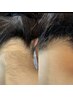 【後ろ姿美人脱毛】 襟足＋背中上部セット